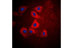 Immunofluorescent analysis of HEXB staining in HepG2 cells. (HEXB antibody  (C-Term))