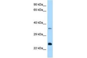 Image no. 1 for anti-RAB13, Member RAS Oncogene Family (RAB13) (AA 91-140) antibody (ABIN6748034) (RAB13 antibody  (AA 91-140))