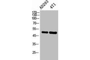 Western Blot analysis of AD293, 4T1 cells using IL-6Rα Polyclonal Antibody. (IL-6 Receptor antibody  (Internal Region))