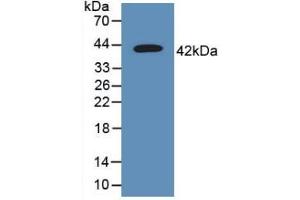 Western blot analysis of recombinant Human TSPAN30. (CD63 antibody  (AA 103-203))