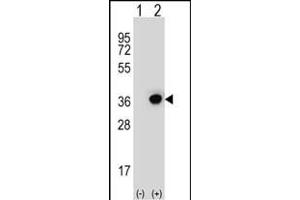 Western blot analysis of DHRS3 (arrow) using rabbit polyclonal DHRS3 Antibody (Center) (ABIN653135 and ABIN2842711). (DHRS3 antibody  (AA 85-113))