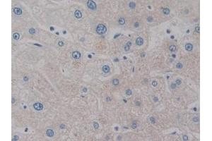 Detection of IL2 in Human Liver Tissue using Monoclonal Antibody to Interleukin 2 (IL2) (IL-2 antibody  (AA 21-153))