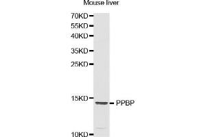 Western Blotting (WB) image for anti-Pro-Platelet Basic Protein (Chemokine (C-X-C Motif) Ligand 7) (PPBP) (AA 31-128) antibody (ABIN1513400) (CXCL7 antibody  (AA 31-128))