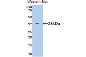 Western blot analysis of the recombinant protein. (LDHB antibody  (AA 1-334))