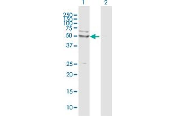 PORCN anticorps  (AA 1-450)