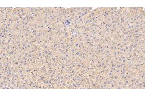 Detection of APOE in Rat Liver Tissue using Monoclonal Antibody to Apolipoprotein E (APOE) (APOE antibody  (AA 19-168))