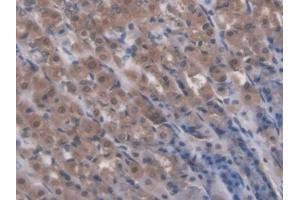 Detection of RIPK1 in Rat Stomach Tissue using Polyclonal Antibody to Receptor Interacting Serine Threonine Kinase 1 (RIPK1) (RIPK1 antibody  (AA 1-179))