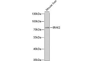 Western blot analysis of extracts of mouse liver, using IR antibody (ABIN3016606, ABIN3016607, ABIN3016608 and ABIN6219797) at 1:1000 dilution. (IRAK2 antibody  (AA 1-270))