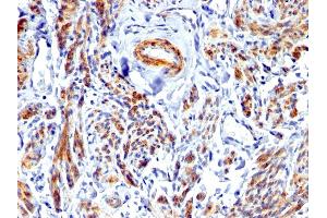 Formalin-fixed, paraffin-embedded human Uterus stained with Caldesmon Rabbit Polyclonal Antibody. (Caldesmon antibody)