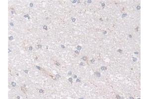 Detection of NDUFS1 in Human Cerebrum Tissue using Polyclonal Antibody to NADH Dehydrogenase Ubiquinone Fe-S Protein 1 (NDUFS1) (NDUFS1 antibody  (AA 524-727))