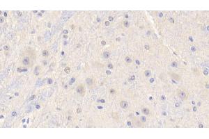Detection of IGF1 in Mouse Cerebrum Tissue using Polyclonal Antibody to Insulin Like Growth Factor 1 (IGF1) (IGF1 antibody  (AA 33-102))