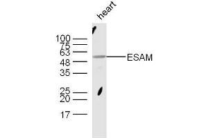 Mouse heart lysates probed with Rabbit Anti-ESAM Polyclonal Antibody, Unconjugated  at 1:300 overnight at 4˚C. (ESAM antibody  (AA 21-120))