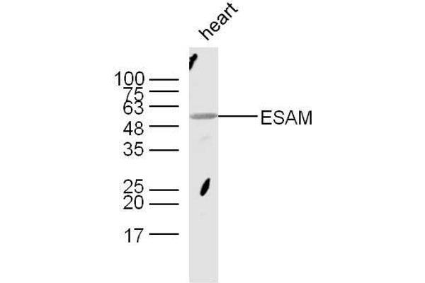 ESAM Antikörper  (AA 21-120)