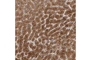Immunohistochemical staining of human liver with ZNF160 polyclonal antibody  shows strong cytoplasmic positivity in hepatocytes.