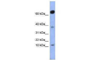 NKX6-3 antibody used at 0. (NK6 Homeobox 3 antibody  (Middle Region))