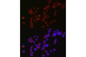 Immunofluorescence analysis of Neuro-2a cells using DCX Rabbit pAb (ABIN3021509, ABIN3021510, ABIN3021511 and ABIN6215166) at dilution of 1:50 (40x lens). (Doublecortin antibody  (AA 11-360))
