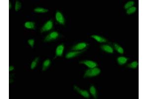 Immunofluorescence staining of Hela cells with ABIN7163794 at 1:133, counter-stained with DAPI. (PCGF1 antibody  (AA 113-187))