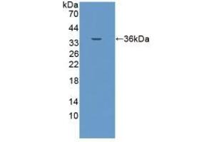 Detection of Recombinant EPCAM, Porcine using Polyclonal Antibody to Epithelial Cell Adhesion Molecule (EPCAM) (EpCAM antibody  (AA 25-265))