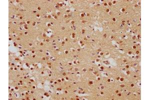 IHC image of ABIN7139839 diluted at 1:500 and staining in paraffin-embedded human brain tissue performed on a Leica BondTM system. (Foxo6 antibody  (AA 211-218))