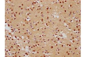 IHC image of ABIN7139839 diluted at 1:500 and staining in paraffin-embedded human brain tissue performed on a Leica BondTM system. (Foxo6 antibody  (AA 211-218))