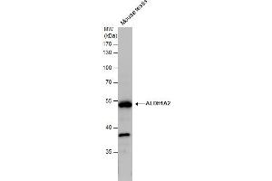 WB Image ALDH1A2 antibody detects ALDH1A2 protein by western blot analysis. (ALDH1A2 antibody)