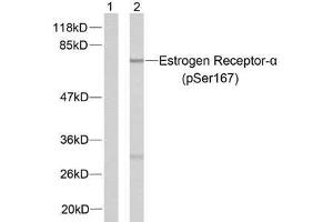 Western blot analysis of extracts from MCF7 cells using Estrogen Receptor-α (phospho-Ser167) antibody (E011073). (Estrogen Receptor alpha antibody  (pSer167))