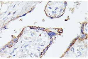 Immunohistochemistry of paraffin-embedded Human placenta using LTF Polyclonal Antibody at dilution of 1:100 (40x lens). (Lactoferrin antibody)