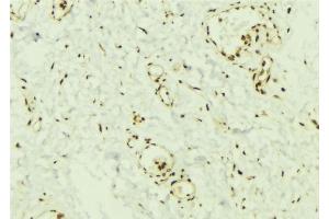ABIN6269368 at 1/100 staining Mouse muscle tissue by IHC-P. (SMAD2 antibody  (C-Term))
