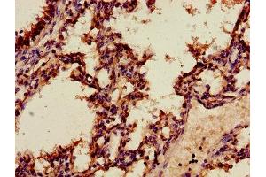 Immunohistochemistry of paraffin-embedded human lung tissue using ABIN7144268 at dilution of 1:100 (Annexin A2 antibody  (AA 2-339))