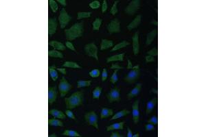 Immunofluorescence analysis of L929 cells using PTK2B antibody (ABIN7269745) at dilution of 1:100. (PTK2B antibody  (AA 1-100))