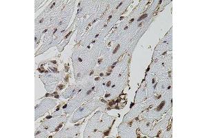 Immunohistochemistry (Paraffin-embedded Sections) (IHC (p)) image for anti-Eukaryotic Translation Initiation Factor 4 gamma 2 (EIF4G2) (AA 750-850) antibody (ABIN3016941)
