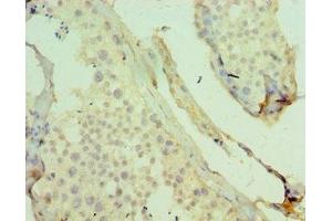 Immunohistochemistry of paraffin-embedded human testis tissue using ABIN7158699 at dilution of 1:100 (KDM4B antibody  (AA 1-260))