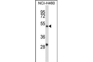 YY2 Antibody (C-term) (ABIN657589 and ABIN2846590) western blot analysis in NCI- cell line lysates (35 μg/lane). (YY2 antibody  (C-Term))