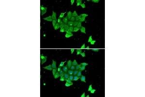 Immunofluorescence (IF) image for anti-phosphohistidine Phosphatase 1 (PHPT1) (AA 1-125) antibody (ABIN3021489) (PHPT1 antibody  (AA 1-125))
