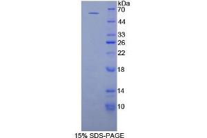 Image no. 1 for Proliferating Cell Nuclear Antigen (PCNA) (AA 6-261) protein (His tag,GST tag) (ABIN6239984) (PCNA Protein (AA 6-261) (His tag,GST tag))