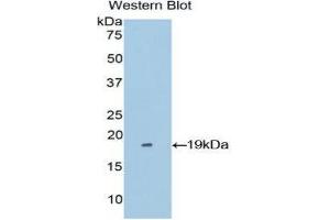 Western Blotting (WB) image for anti-Periostin (POSTN) (AA 500-630) antibody (ABIN1860279) (Periostin antibody  (AA 500-630))