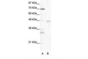 Image no. 1 for anti-Heat Shock Transcription Factor 4 (HSF4) (AA 172-221) antibody (ABIN203154)