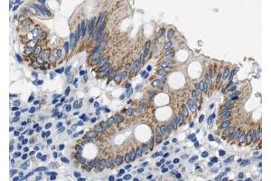 ABIN6268714 at 1/100 staining human colon tissue sections by IHC-P. (CXCL12 antibody  (C-Term))