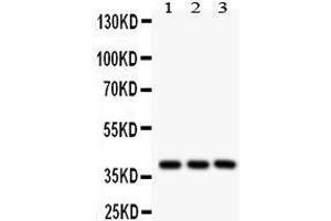 Western Blotting (WB) image for anti-Prostaglandin E Receptor 2 (Subtype EP2), 53kDa (PTGER2) (AA 281-308), (C-Term) antibody (ABIN3043363) (PTGER2 antibody  (C-Term))