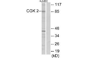 Western blot analysis of extracts from HUVEC cells, using CGK 2 antibody.