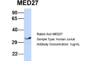 Host: Rabbit Target Name: MED27 Sample Type: Jurkat Antibody Dilution: 1. (MED27 antibody  (Middle Region))
