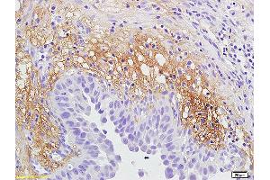 Formalin-fixed and rat lung tissue labeled with Anti-IL12RB2 Polyclonal Antibody (ABIN747878), Unconjugated at 1:200 followed by conjugation to the secondary antibody and DAB staining (IL12RB2 antibody  (AA 301-400))