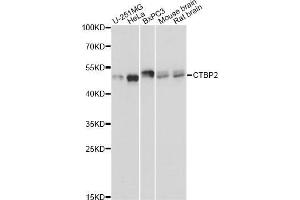 Western blot analysis of extracts of various cell lines, using CTBP2 Antibody (ABIN5971262) at 1:3000 dilution. (CTBP2 antibody)