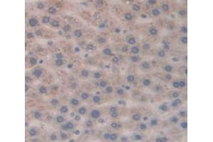 Immunohistochemistry (IHC) image for anti-T-Cell Leukemia/lymphoma 1A (TCL1A) (AA 6-112) antibody (ABIN1860691)