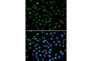 Immunofluorescence analysis of A549 cell using ATF6 antibody. (ATF6 antibody  (AA 1-190))