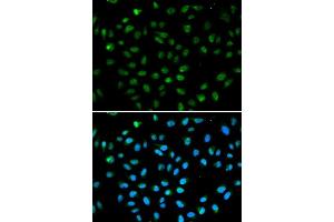 Immunofluorescence analysis of A549 cell using ATF6 antibody. (ATF6 antibody  (AA 1-190))