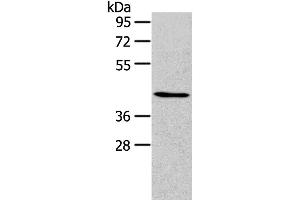 Western Blotting (WB) image for anti-Runt-Related Transcription Factor 2 (RUNX2) antibody (ABIN2431126) (RUNX2 antibody)