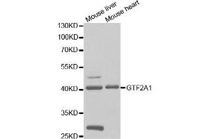 Western Blotting (WB) image for anti-General Transcription Factor IIA, 1, 19/37kDa (GTF2A1) antibody (ABIN1876533) (GTF2A1 antibody)