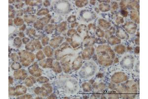 Immunoperoxidase of monoclonal antibody to CNO on formalin-fixed paraffin-embedded human salivary gland.
