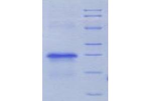 SDS-PAGE analysis of Rat uPAR Protein.